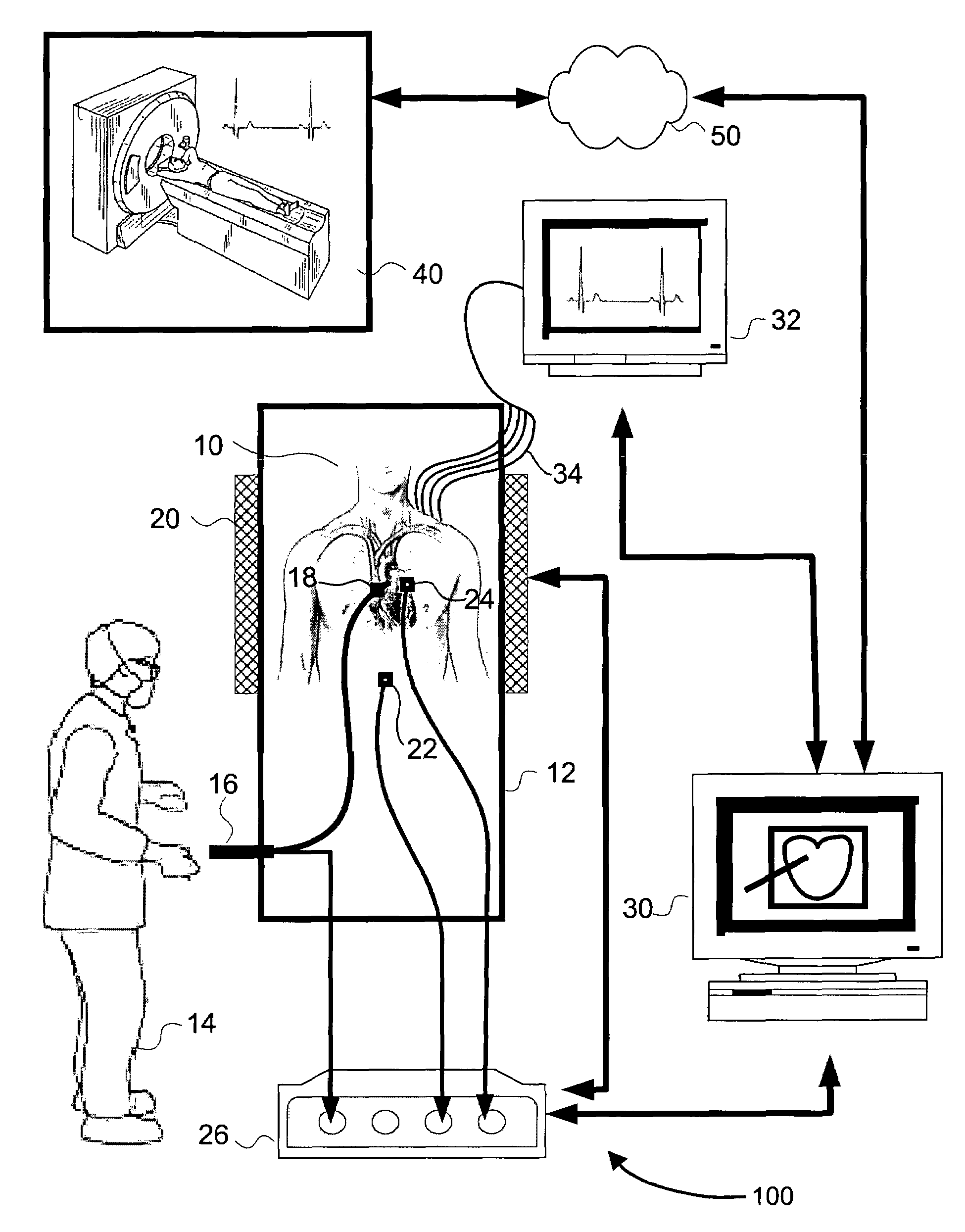 Methods, apparatuses, and systems useful in conducting image guided interventions