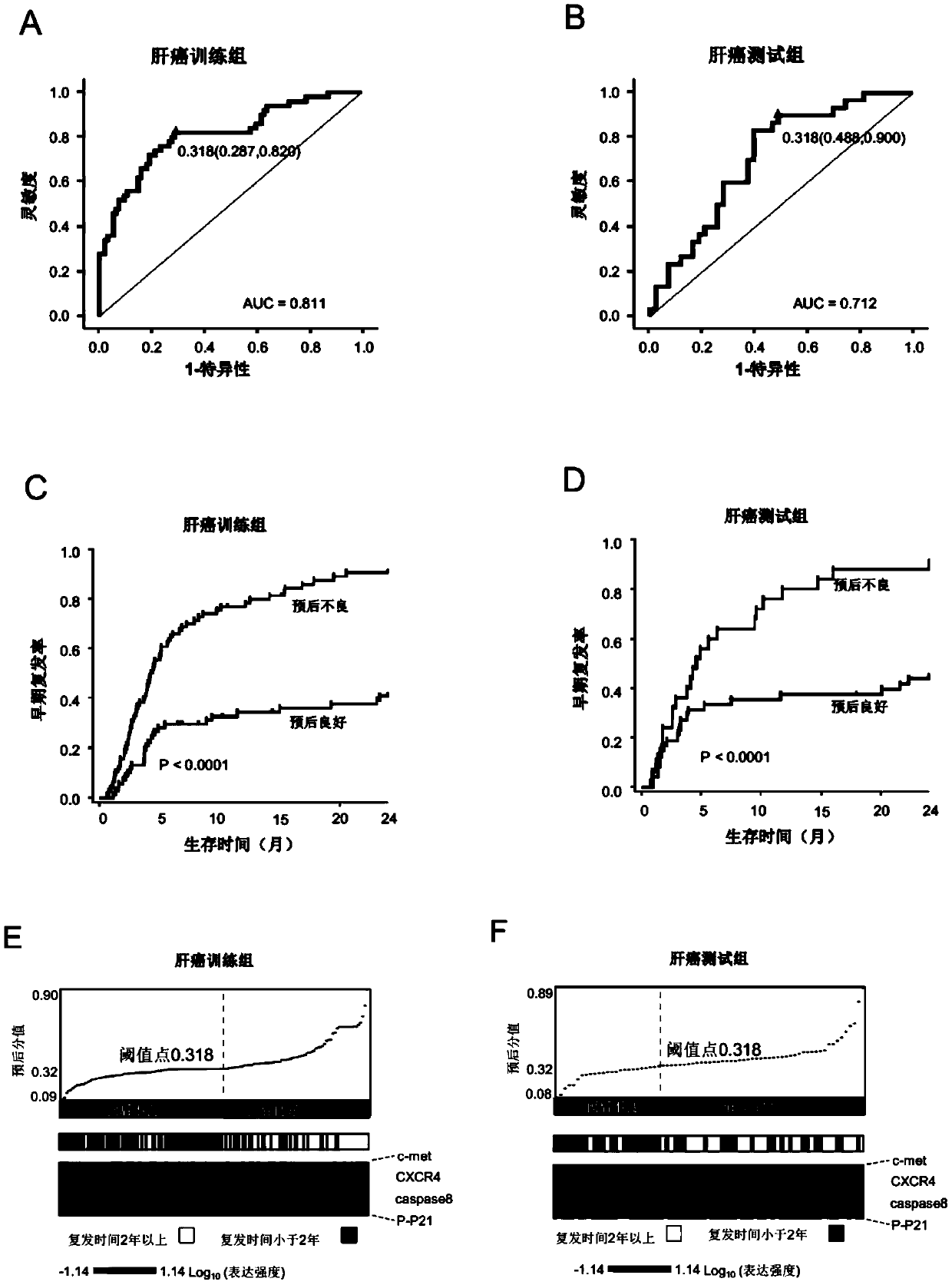 A system for predicting the prognosis of patients with liver cancer