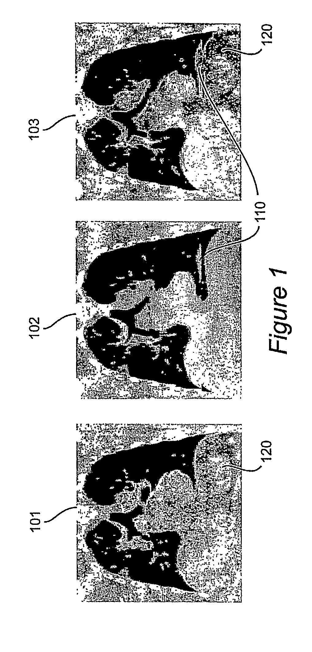 Method And System Of Adaptive Control For Reducing Motion Artifacts And Patient Dose In Four Dimensional Computed Tomography