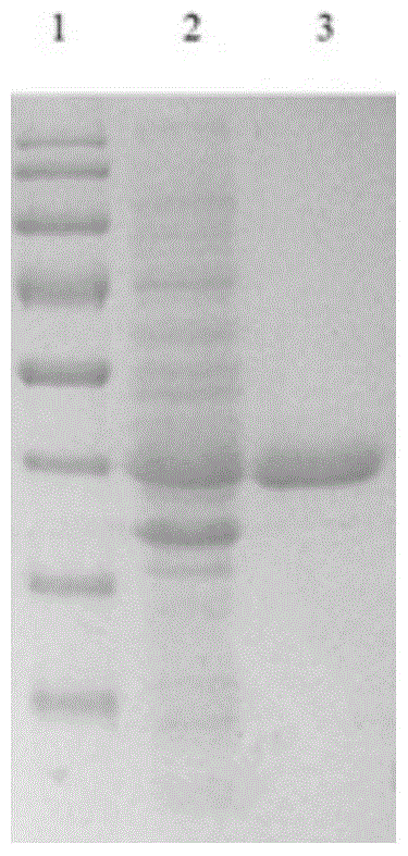 A herpes simplex virus thymidine kinase mutant and its preparation method and use