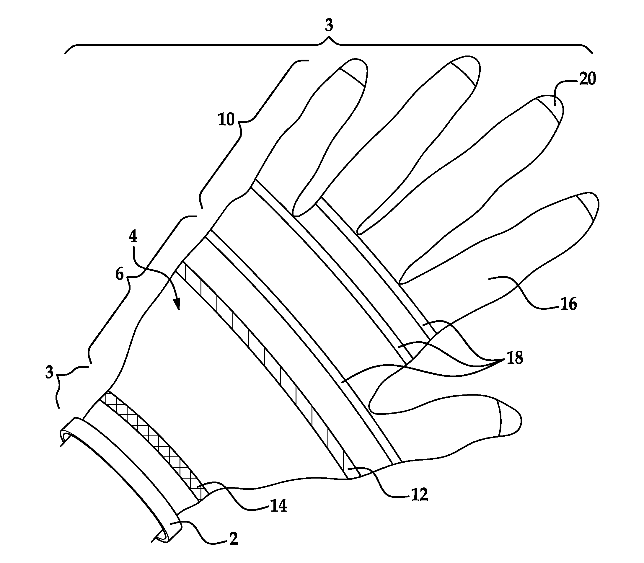 Surgical glove appliance device