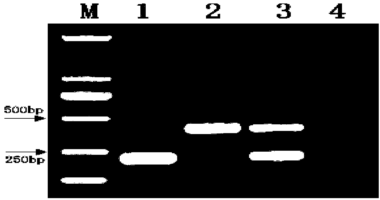 Duplex PCR (polymerase chain reaction) method for synchronously detecting Burkholderia gladioli pv.alliicola and Erwinia chrysanthemi as quarantine bacteria