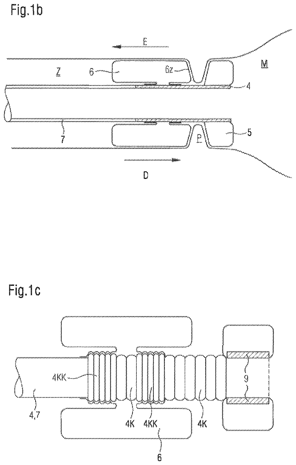 Bypass device for the transpyloric conducting of gastric content into or through the duodenum, and applicator for putting same in place