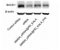 Drug for targeted therapy of Alzheimer's disease (AD) and preparation method thereof