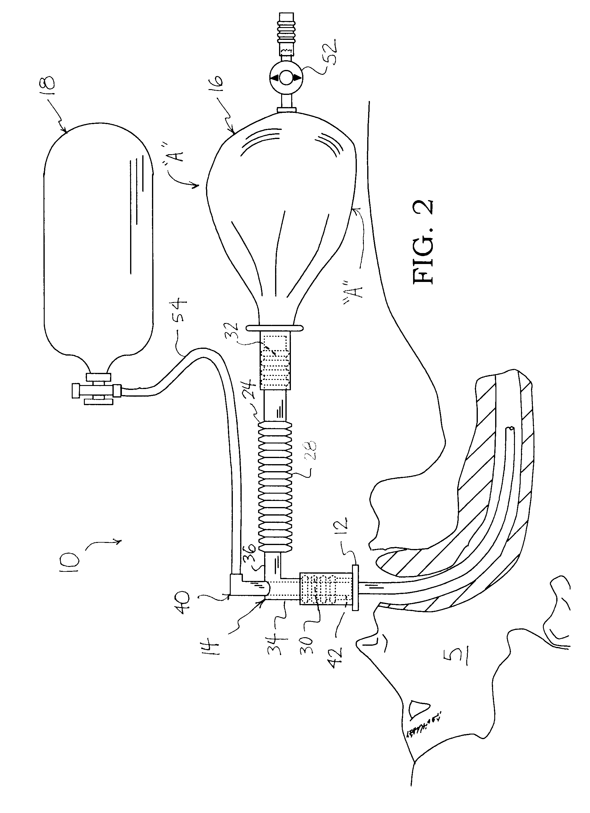 Breathing circuit