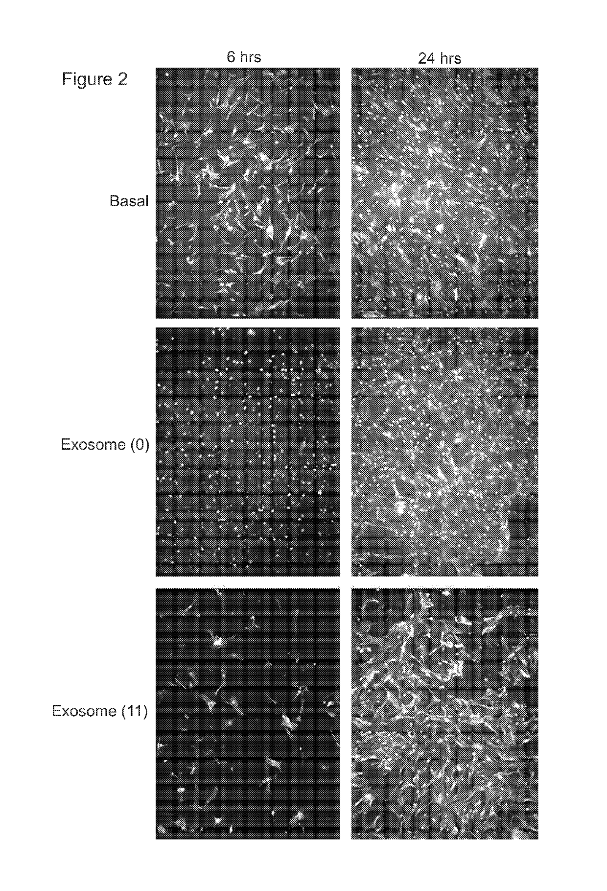 Stem cell microparticles and miRNA