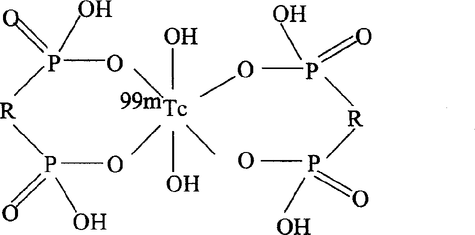 Diphospho-acid complex of radiative technetium-99m marked oxazole phosphinic acid