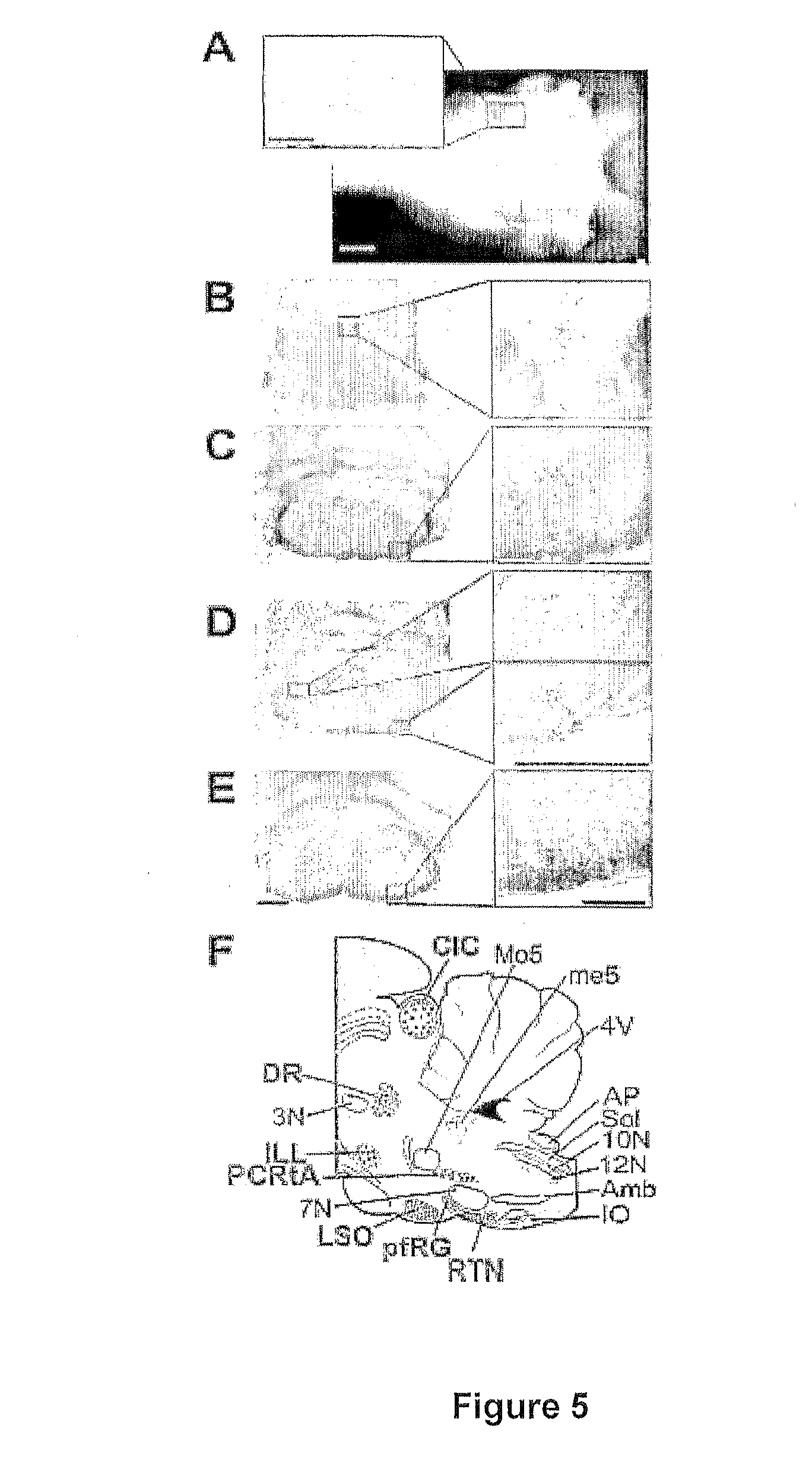 Method of screening for compounds that can be used for the treatment of respiratory conditions