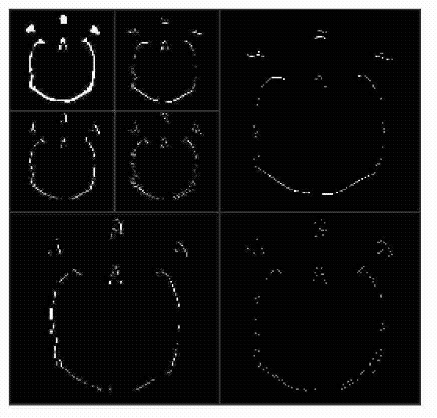 Multimode medical image fusion method based on translation constant shear wave transformation