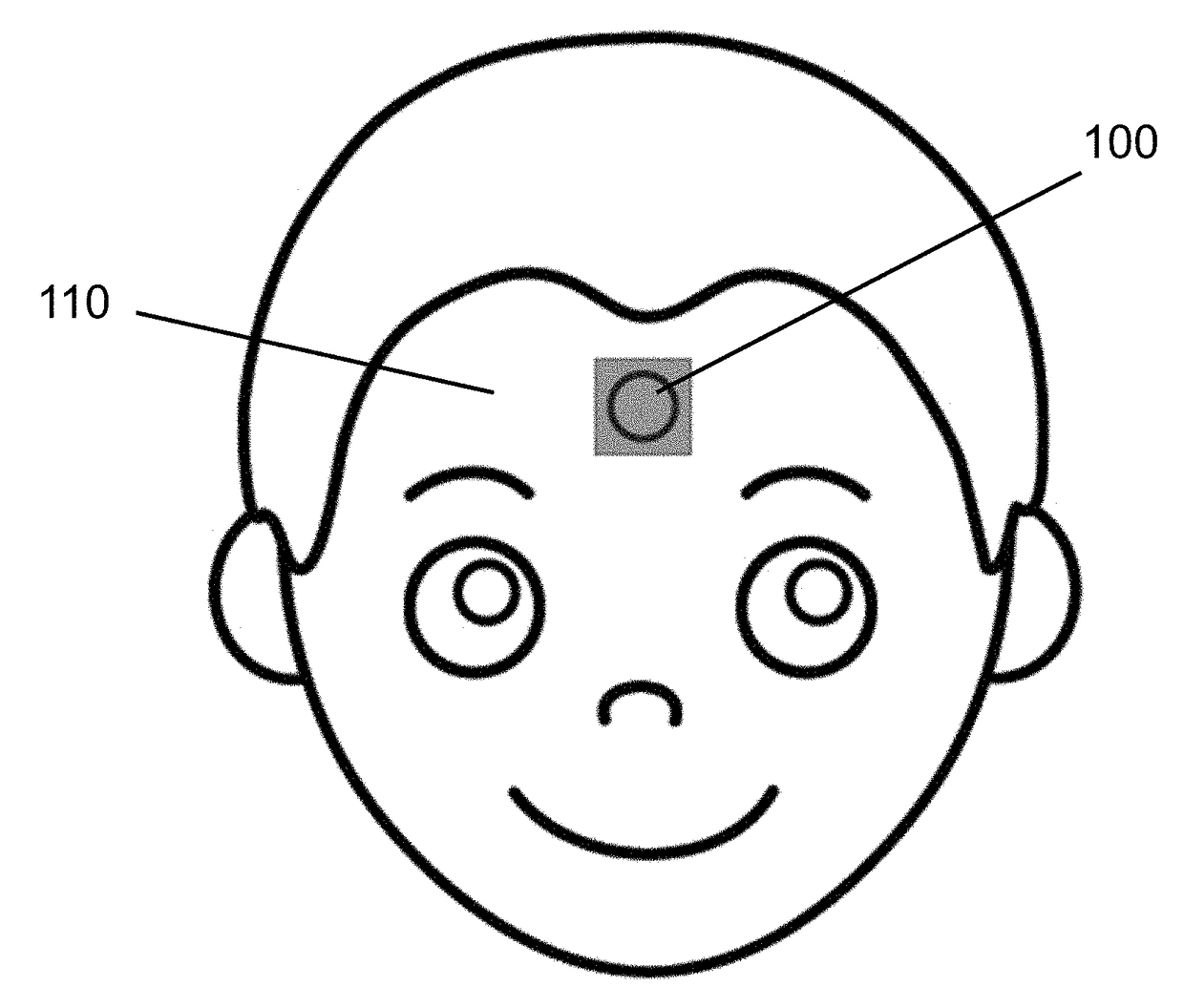 Wearable thermometer patch for correct measurement of human skin temperature