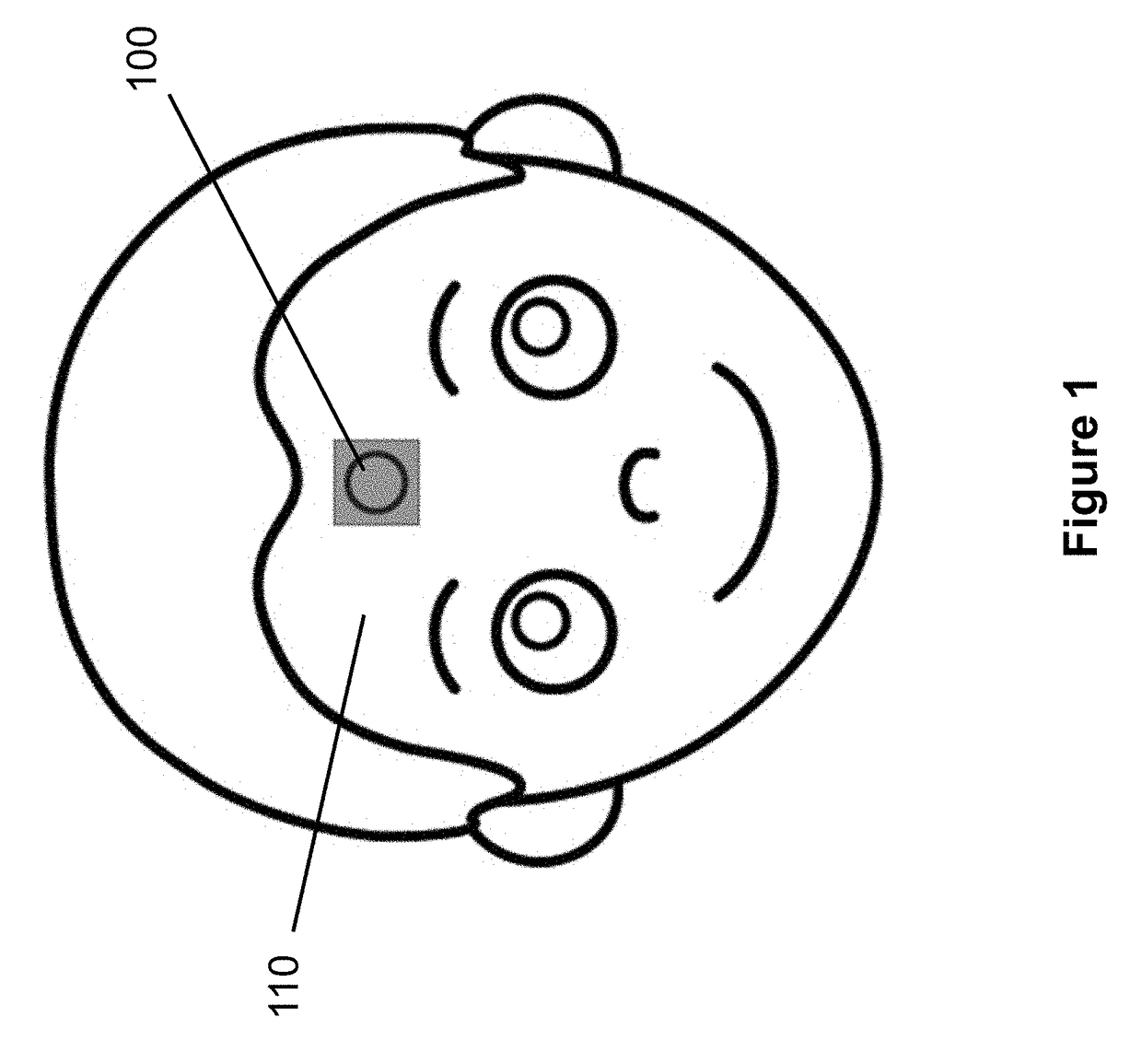 Wearable thermometer patch for correct measurement of human skin temperature