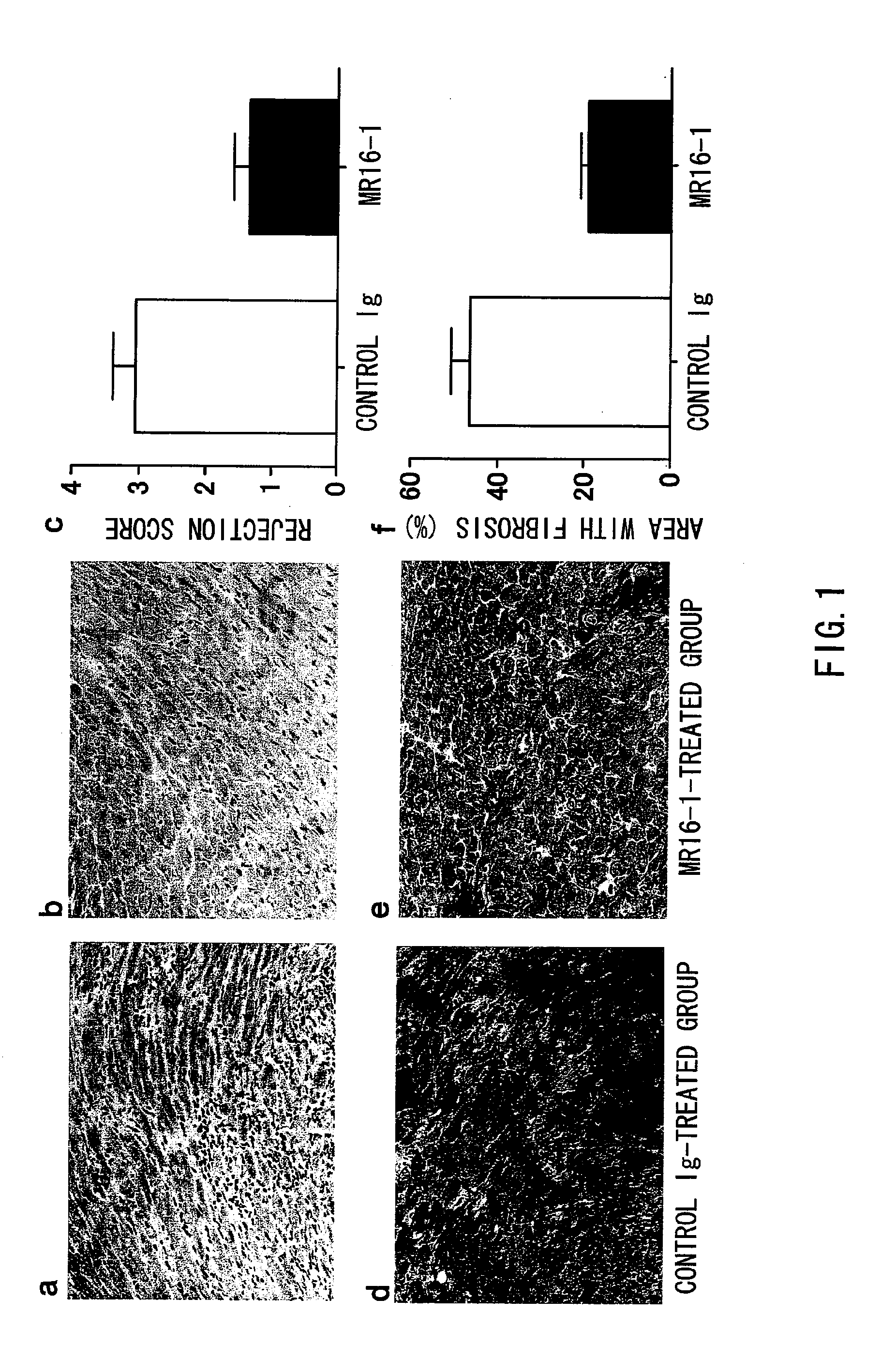 Chronic Rejection Inhibitor