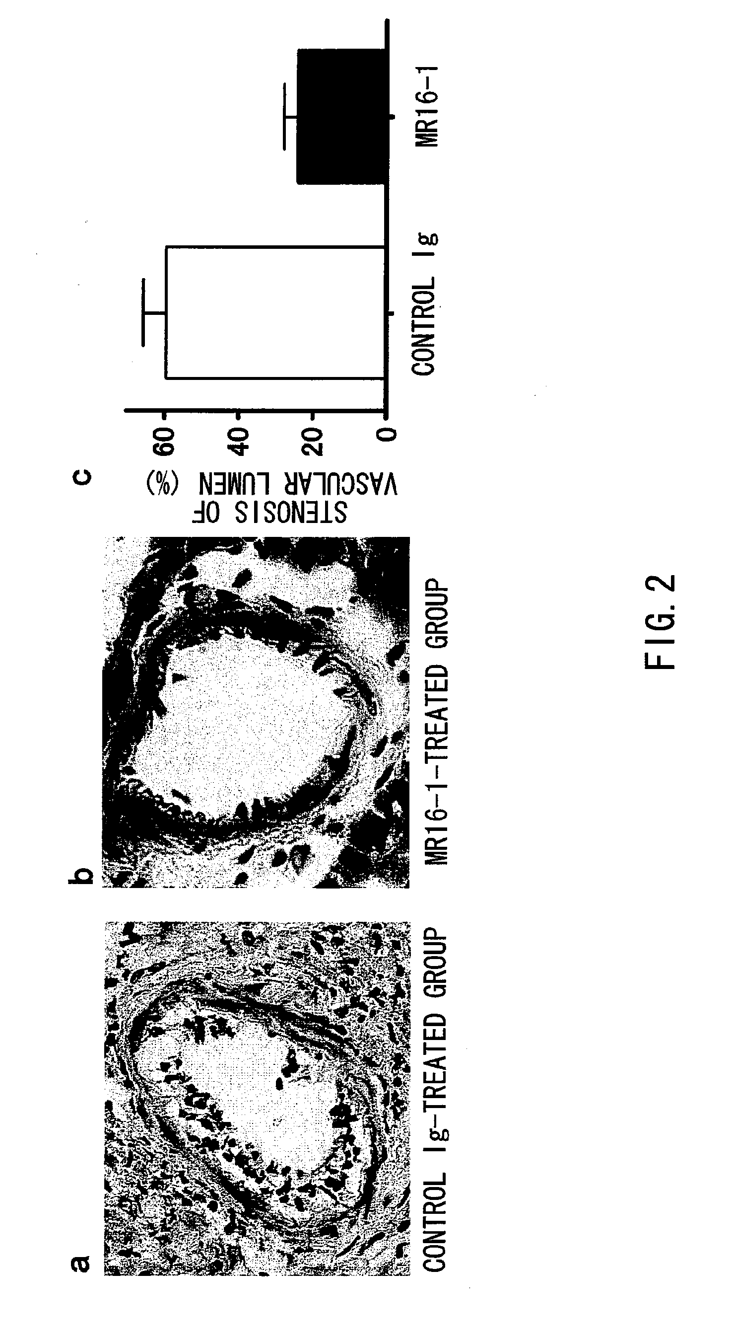 Chronic Rejection Inhibitor