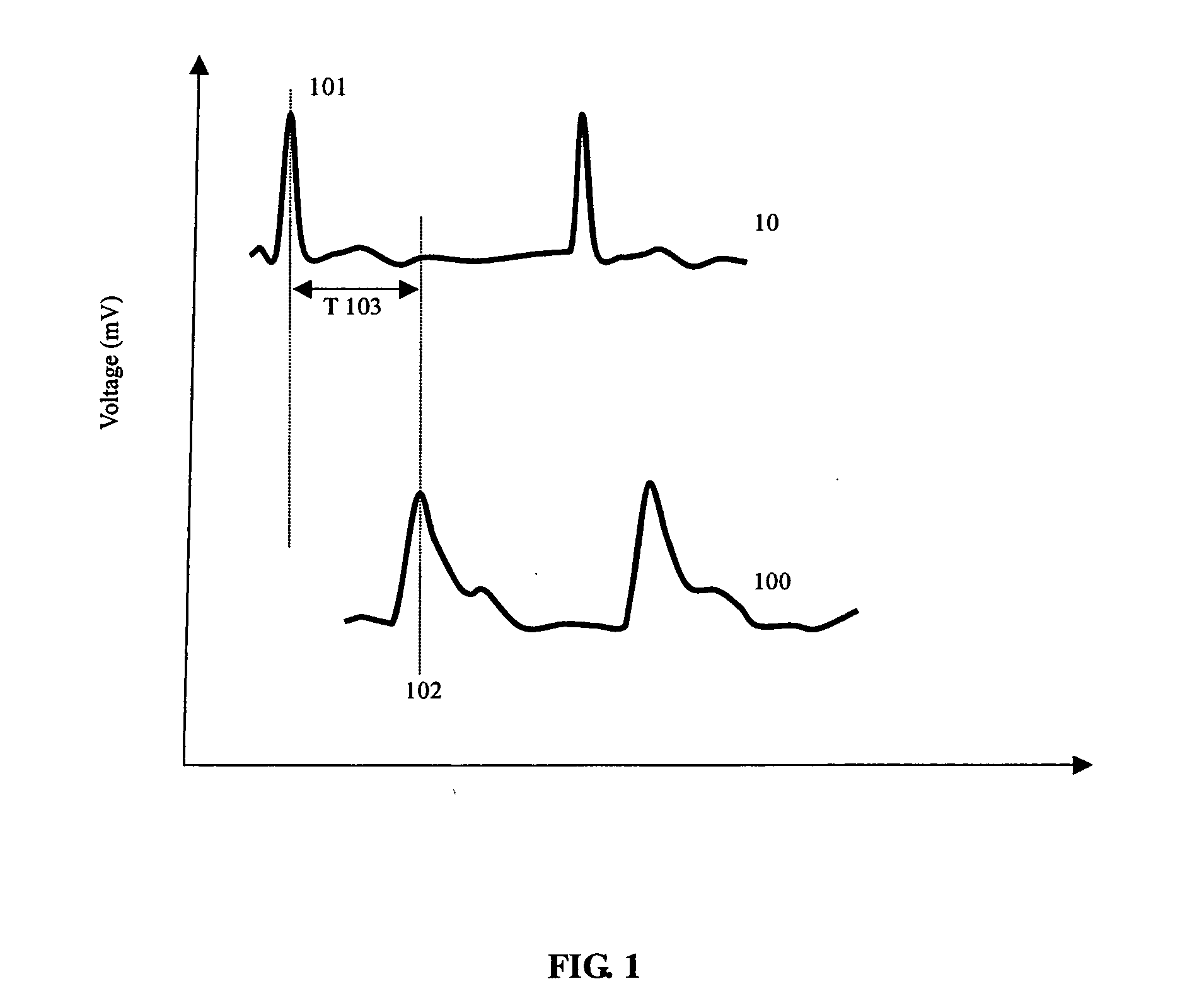 Methods for measuring blood pressure with automatic compensations