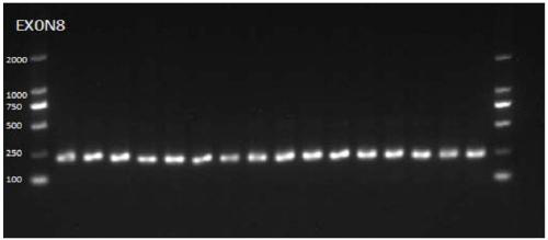 Primer, method and kit for detecting ATRX (X-linked alpha thalassemia mental retardation syndrome) gene locus mutation