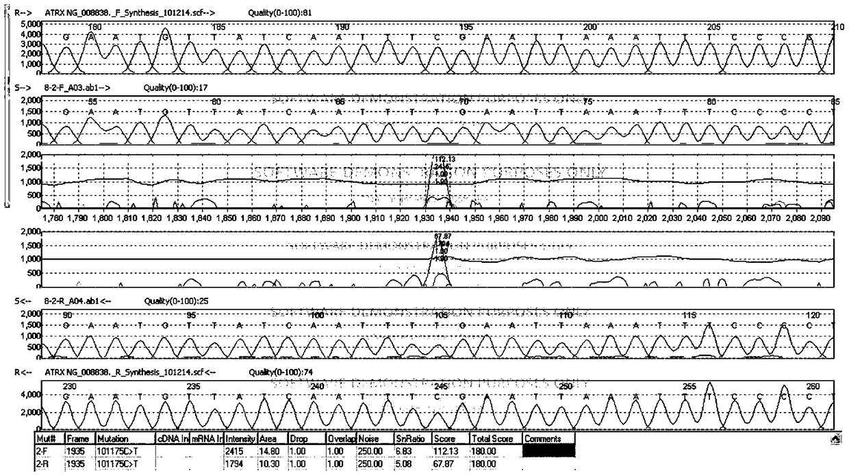 Primer, method and kit for detecting ATRX (X-linked alpha thalassemia mental retardation syndrome) gene locus mutation