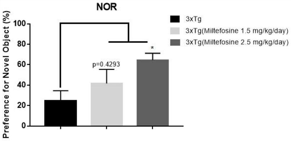 Application of miltefosine and pharmaceutically acceptable salt thereof in preparation of medicine for treating Alzheimer's disease