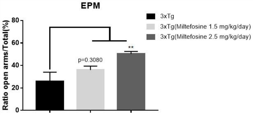 Application of miltefosine and pharmaceutically acceptable salt thereof in preparation of medicine for treating Alzheimer's disease