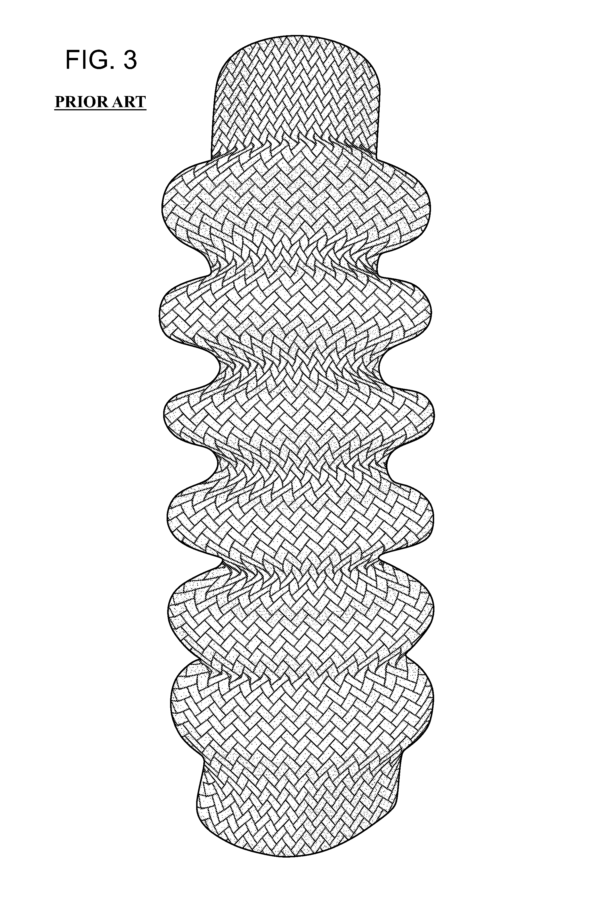 Method of manufacturing corrugated preform using braiding process