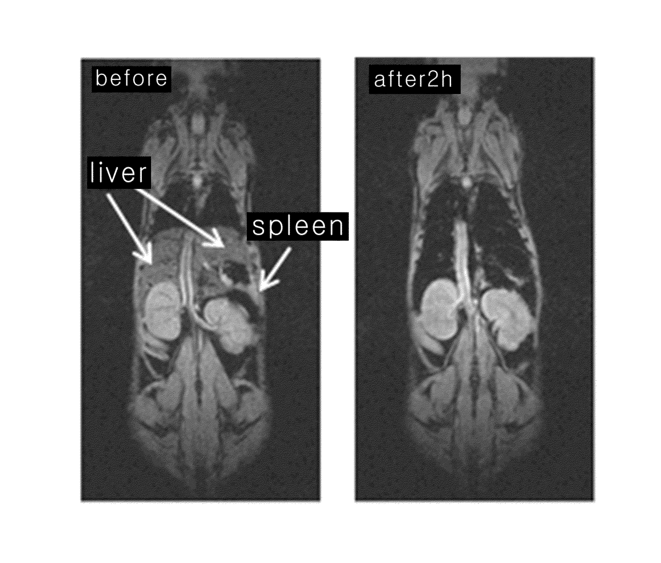 Method of preparing iron oxide nanoparticles coated with hydrophilic material, and magnetic resonance imaging contrast agent using the same