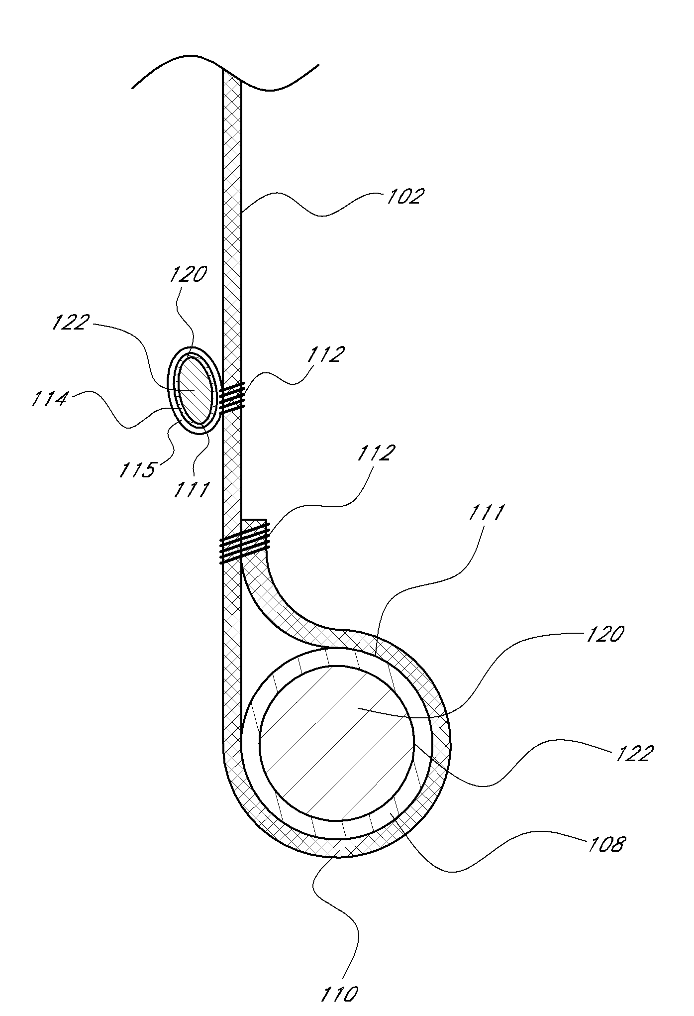 Translumenally implantable heart valve with formed in place support