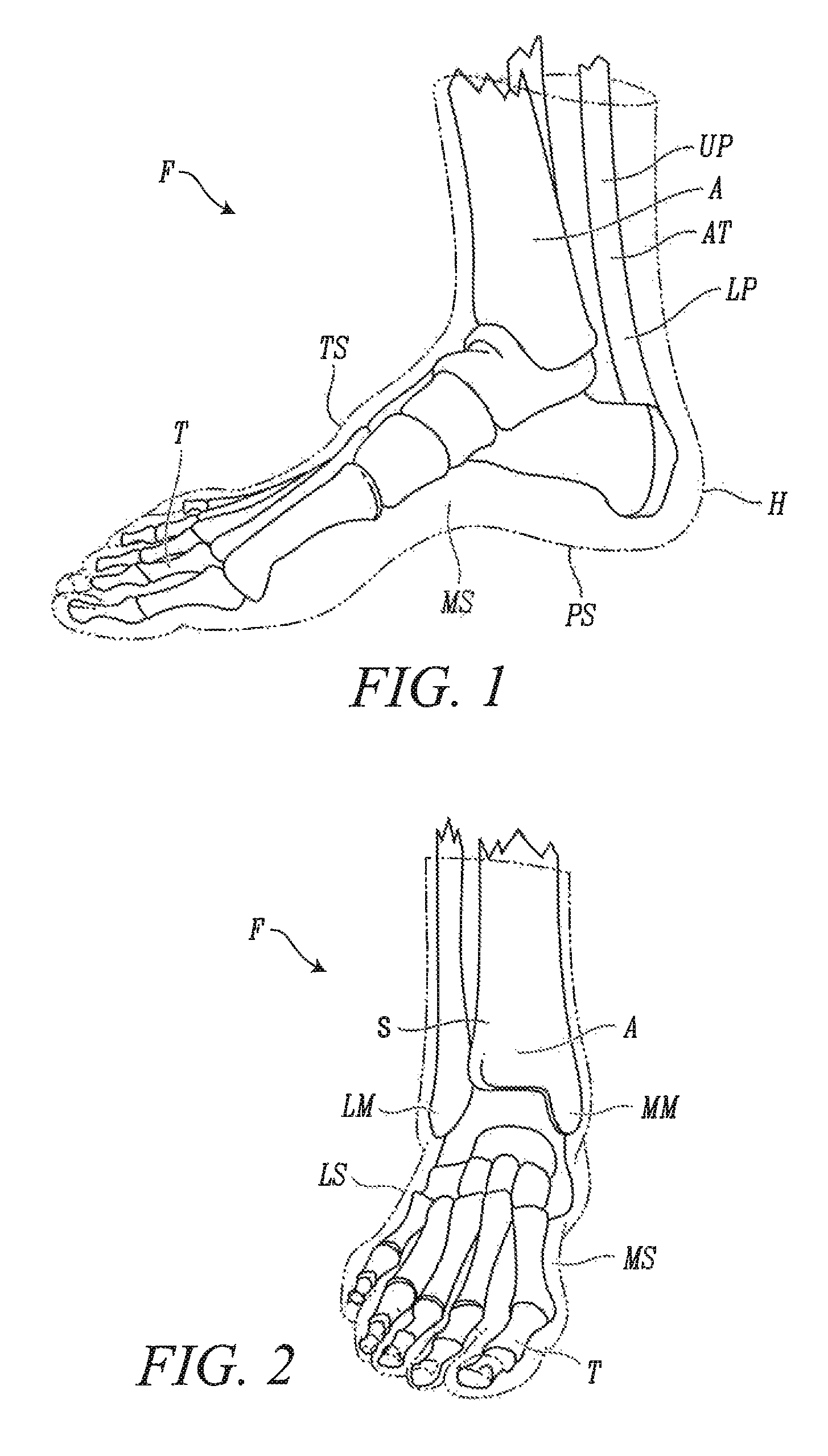 Skate boot having a toe cap with rear extensions