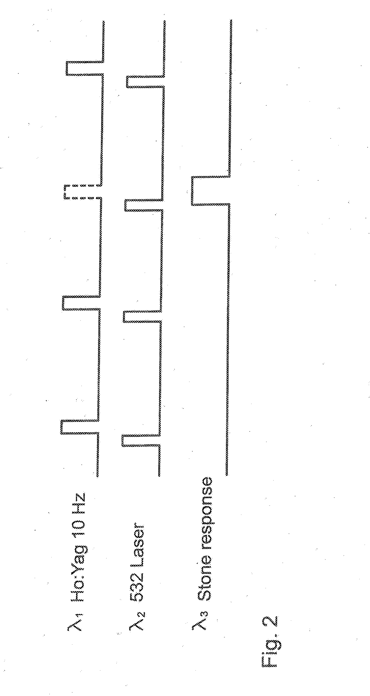 Stone sense with fiber erosion protection and camera saturation prevention, and/or absence-detection safety interlock