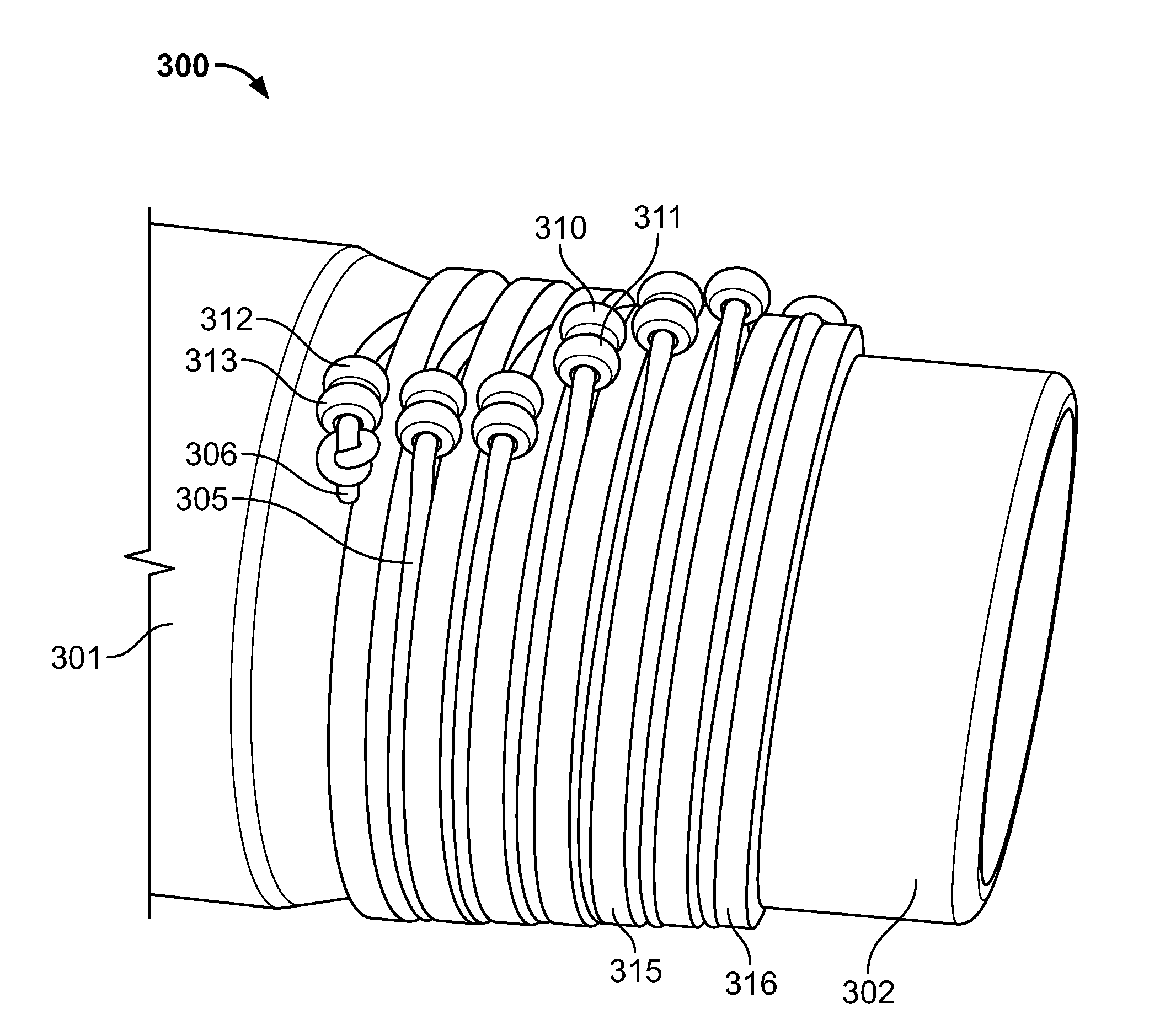 Multiple band endoscopic ligation device