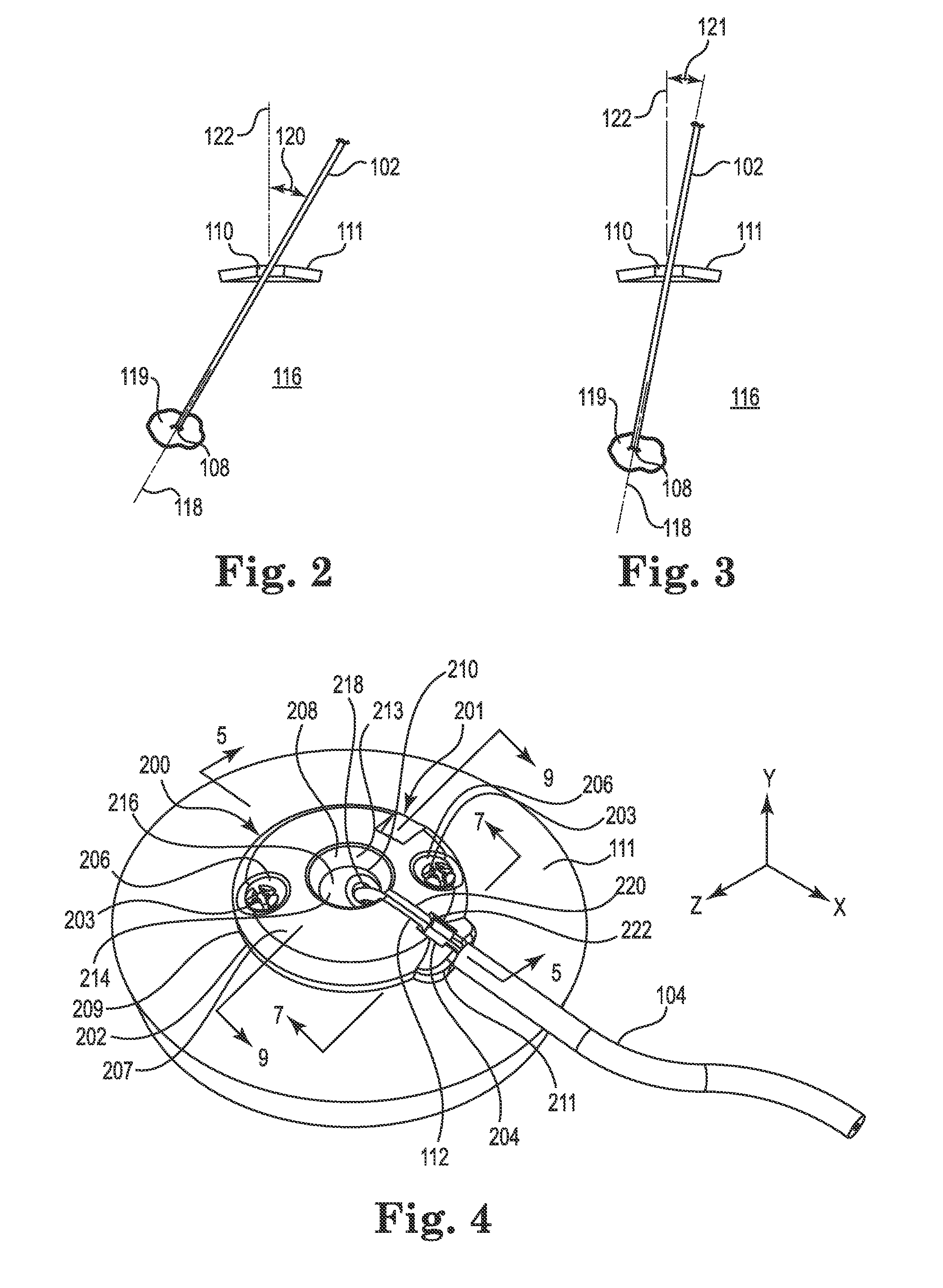 Socketed Portal Anchors and Methods of Using Same