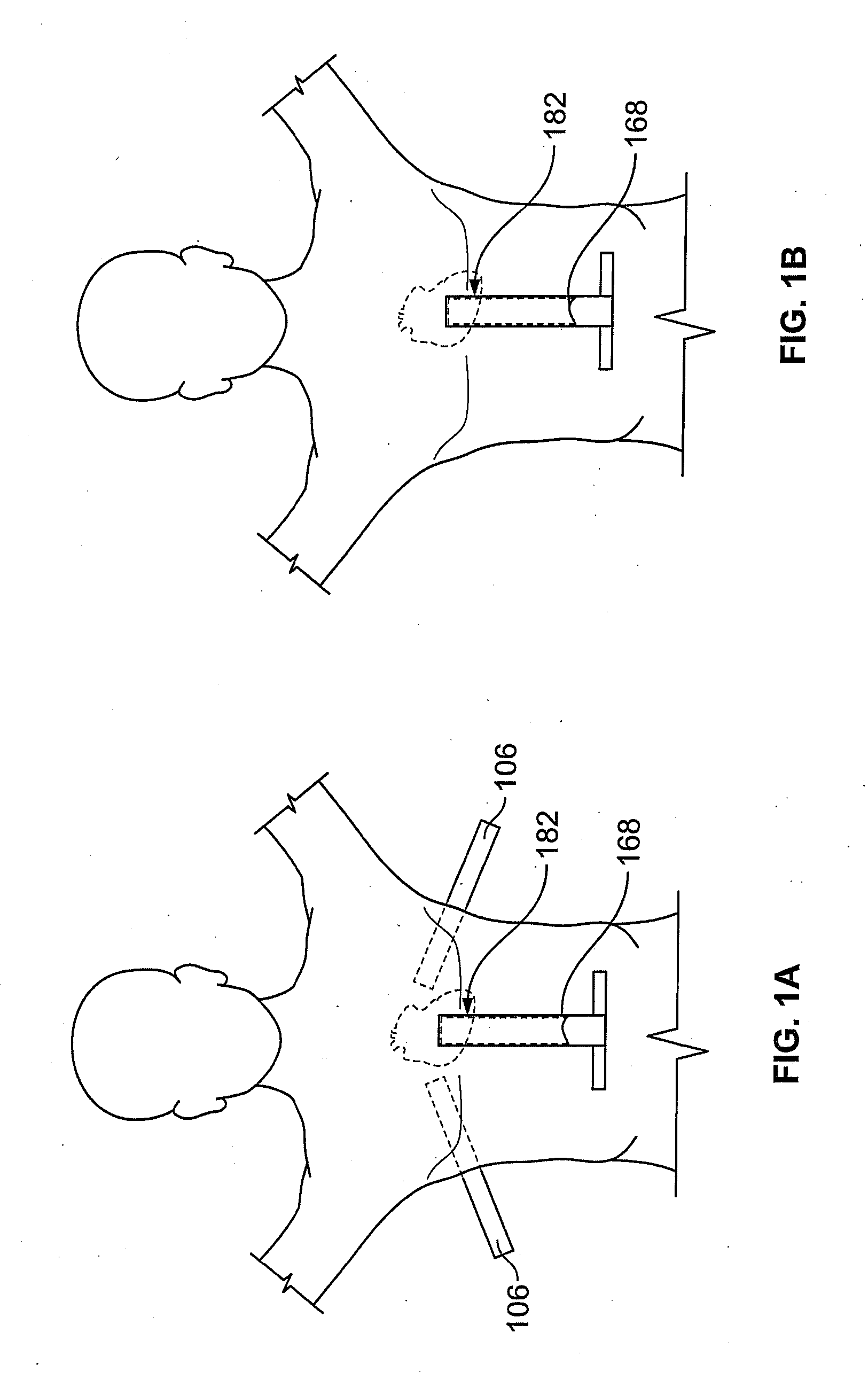 Diaphragm entry for posterior surgical access