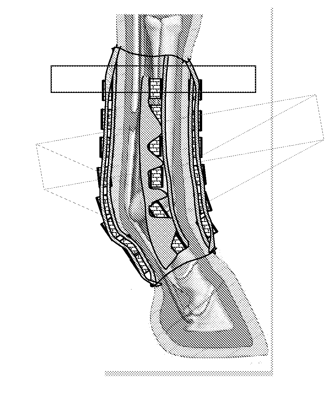 Plurality of Lamination for Soft Tissue Compression Support, Protection and Bracing; Intelligent Textile for Equine and Equestrian Sports or Activities