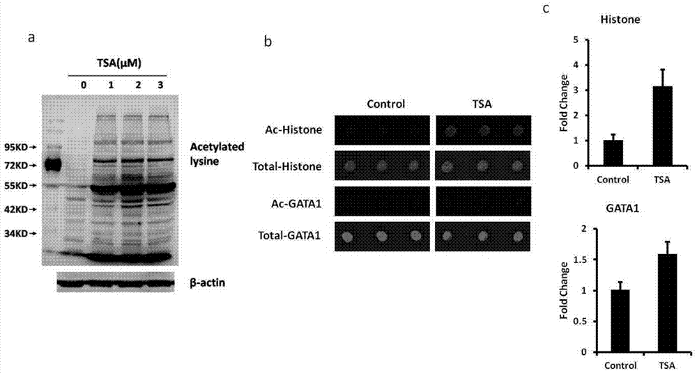 Protein chip and kit for detecting protein acetylation level