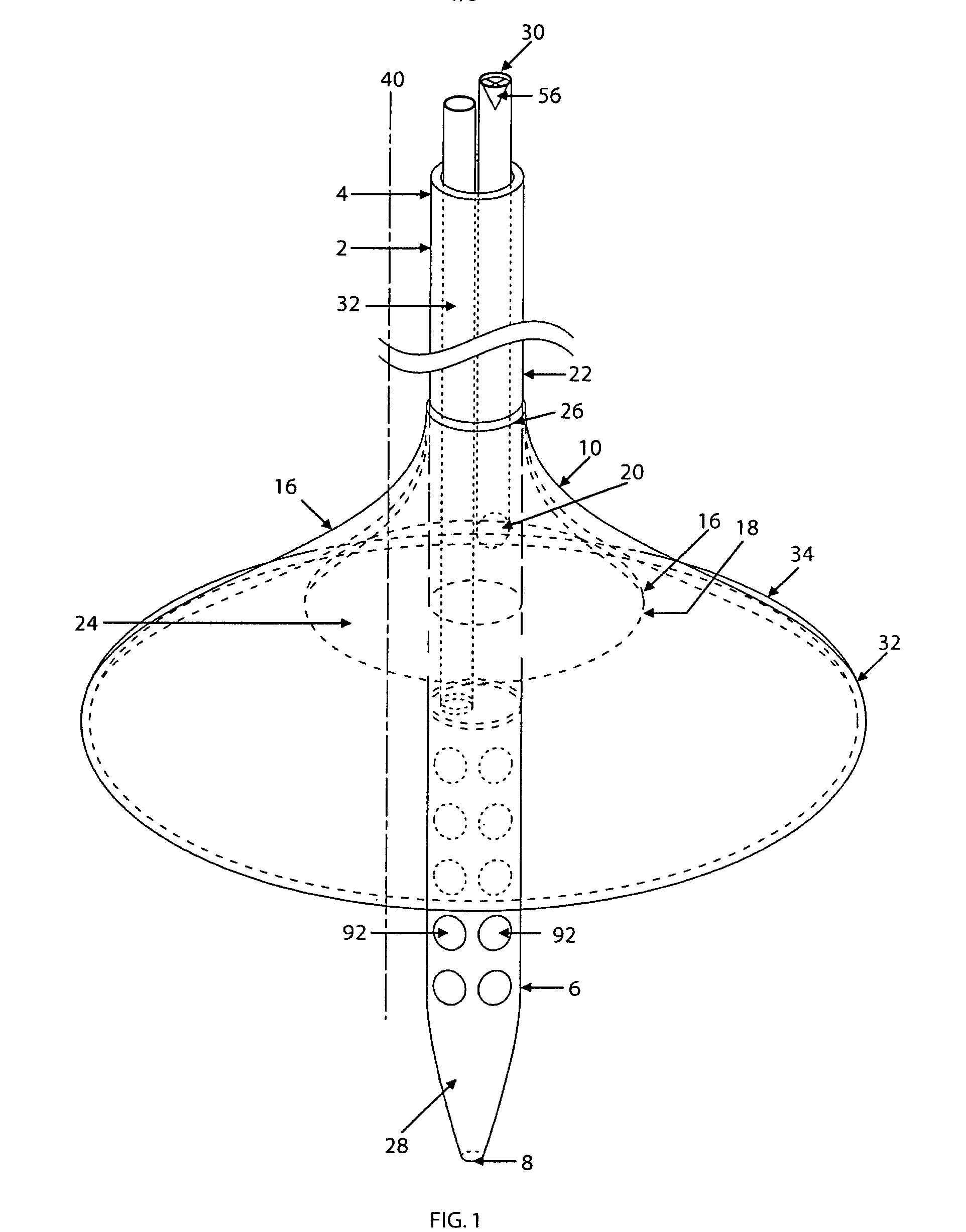 Nasogastric tube anti aspiration device