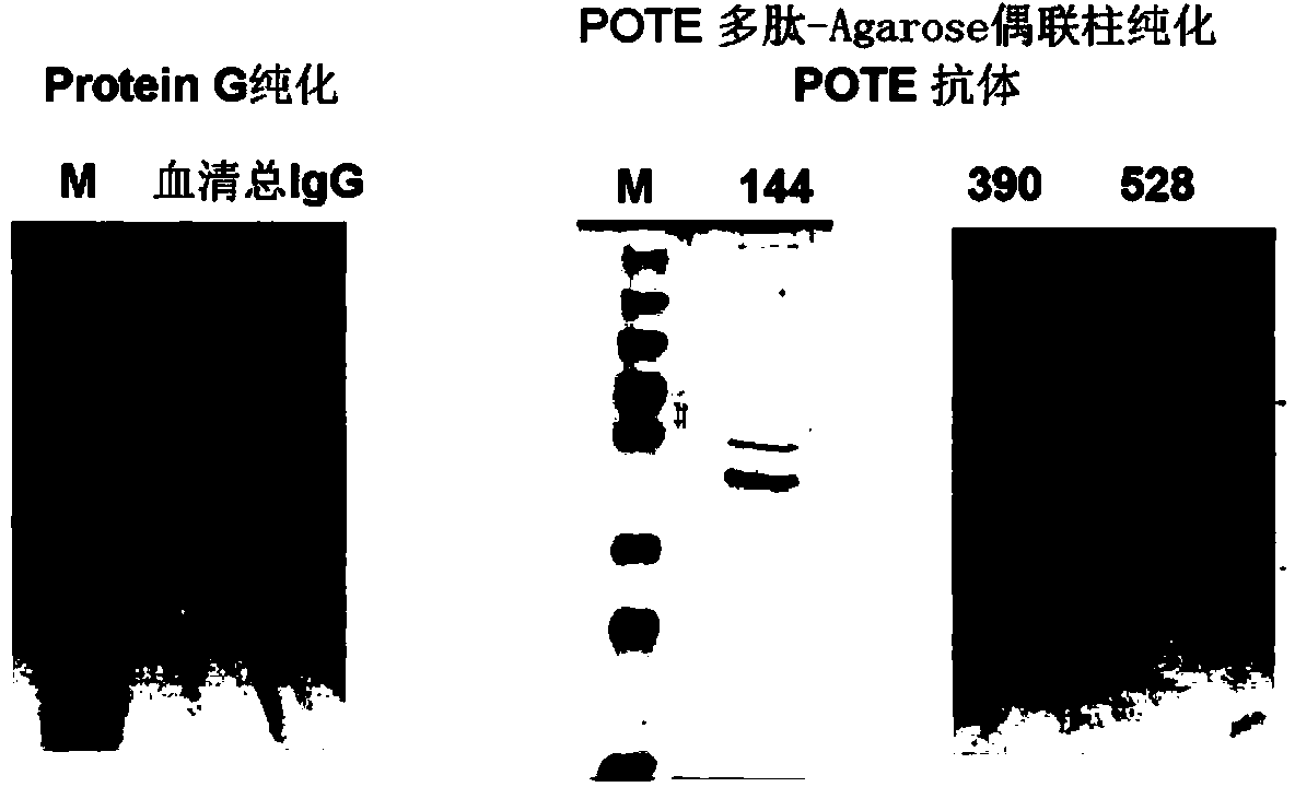 Novel tumour serum marker and application thereof