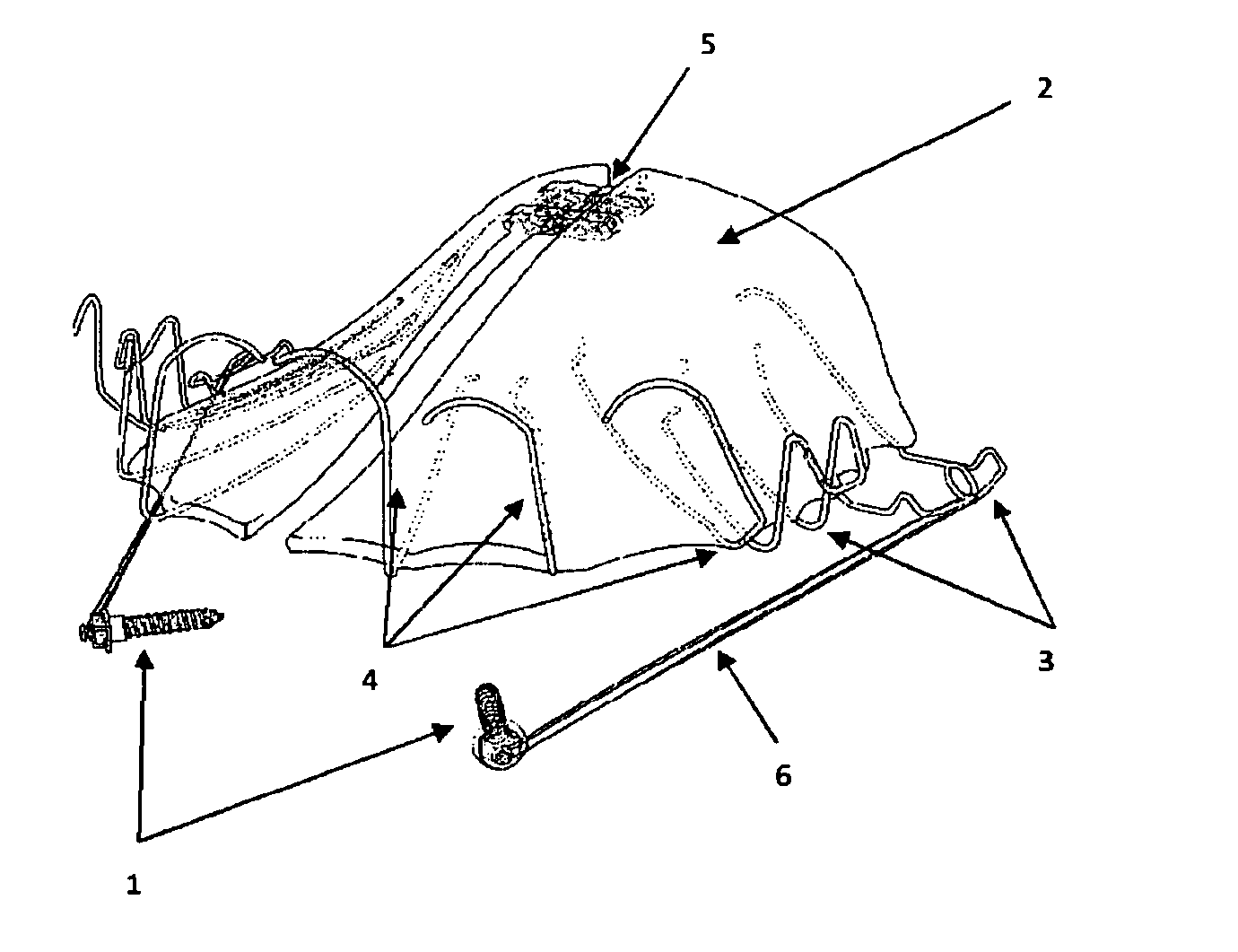 Method and system for treatment of maxillary deficiency using miniscrews