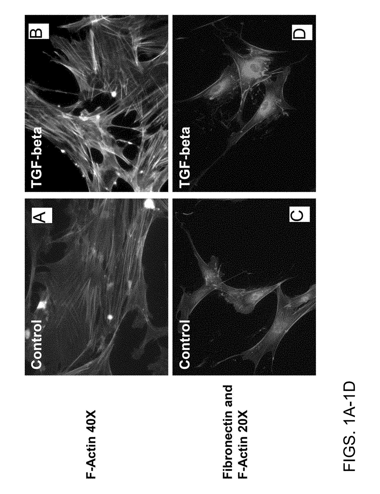 Chemicals and methods to prevent and treat tgf-beta mediated activation of fibroblasts to reduce and treat cancer and fibrosis