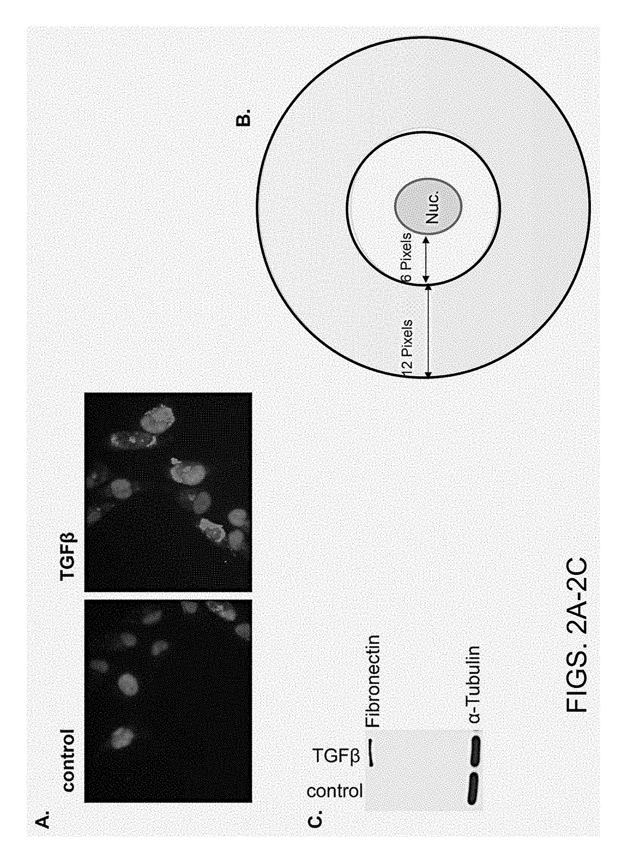 Chemicals and methods to prevent and treat tgf-beta mediated activation of fibroblasts to reduce and treat cancer and fibrosis