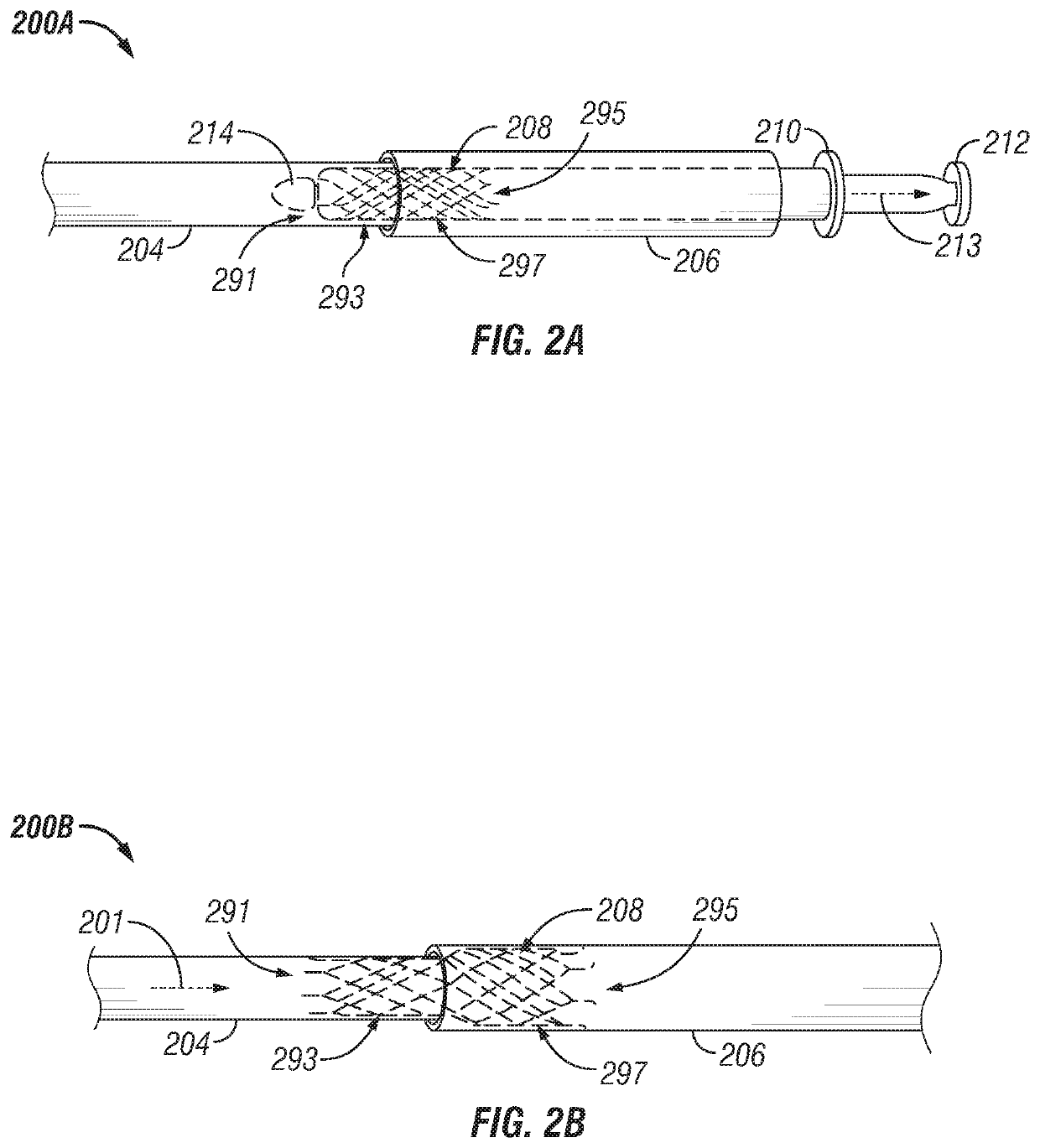 Stent delivery for vascular surgery