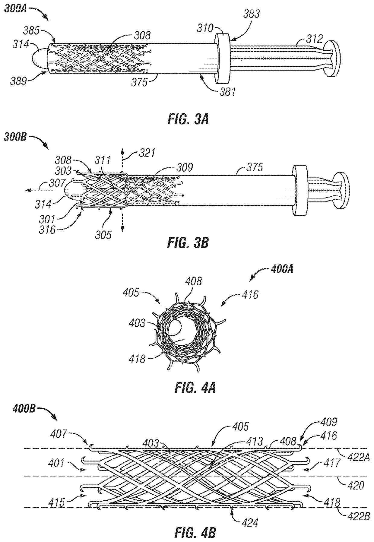 Stent delivery for vascular surgery