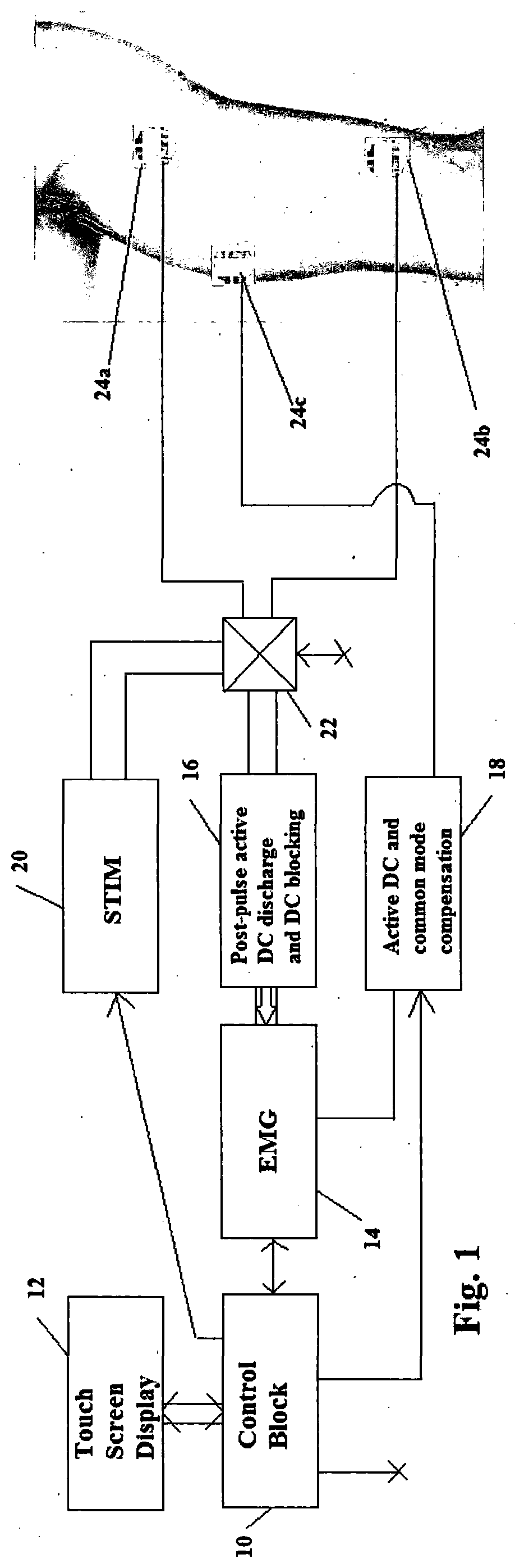 Apparatus for neuromuscular stimulation