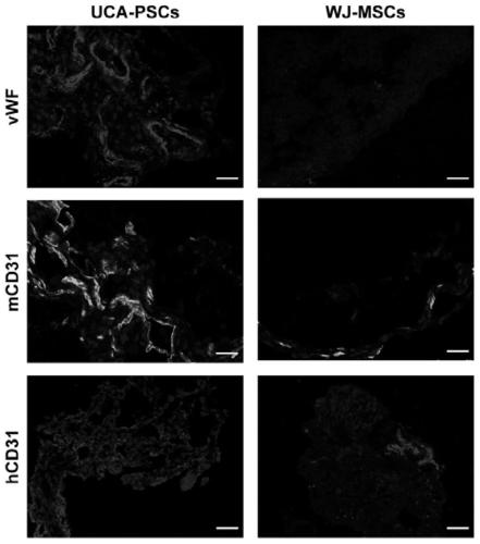 Umbilical artery para-arterial stem cell injection for treating ischemic disease and preparation method thereof