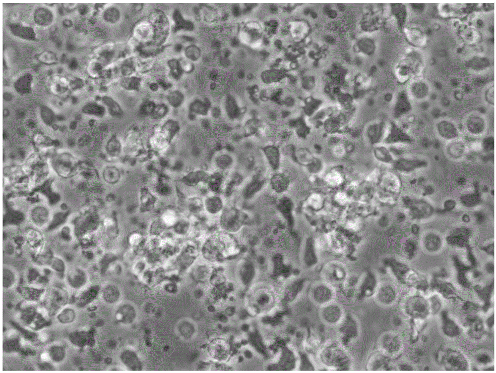 Preparation method for DC-CIK cells originated from umbilical cord blood mononuclear cells and preparation