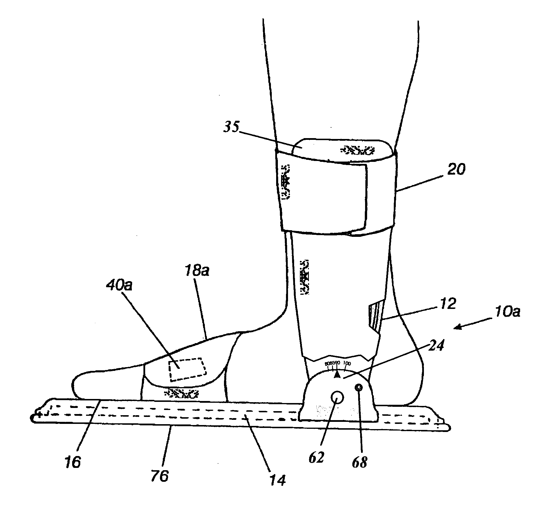 Orthopedic night foot splint