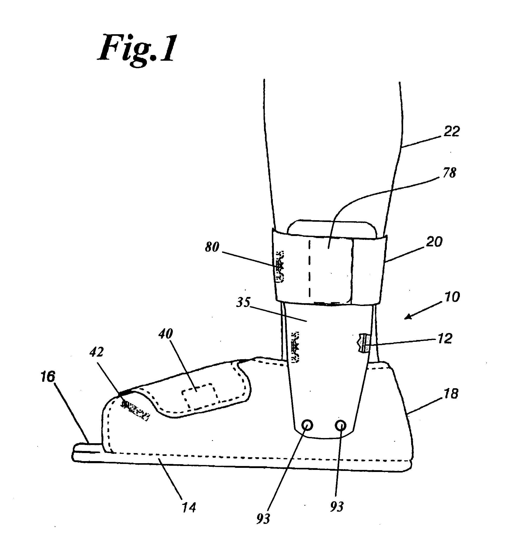 Orthopedic night foot splint