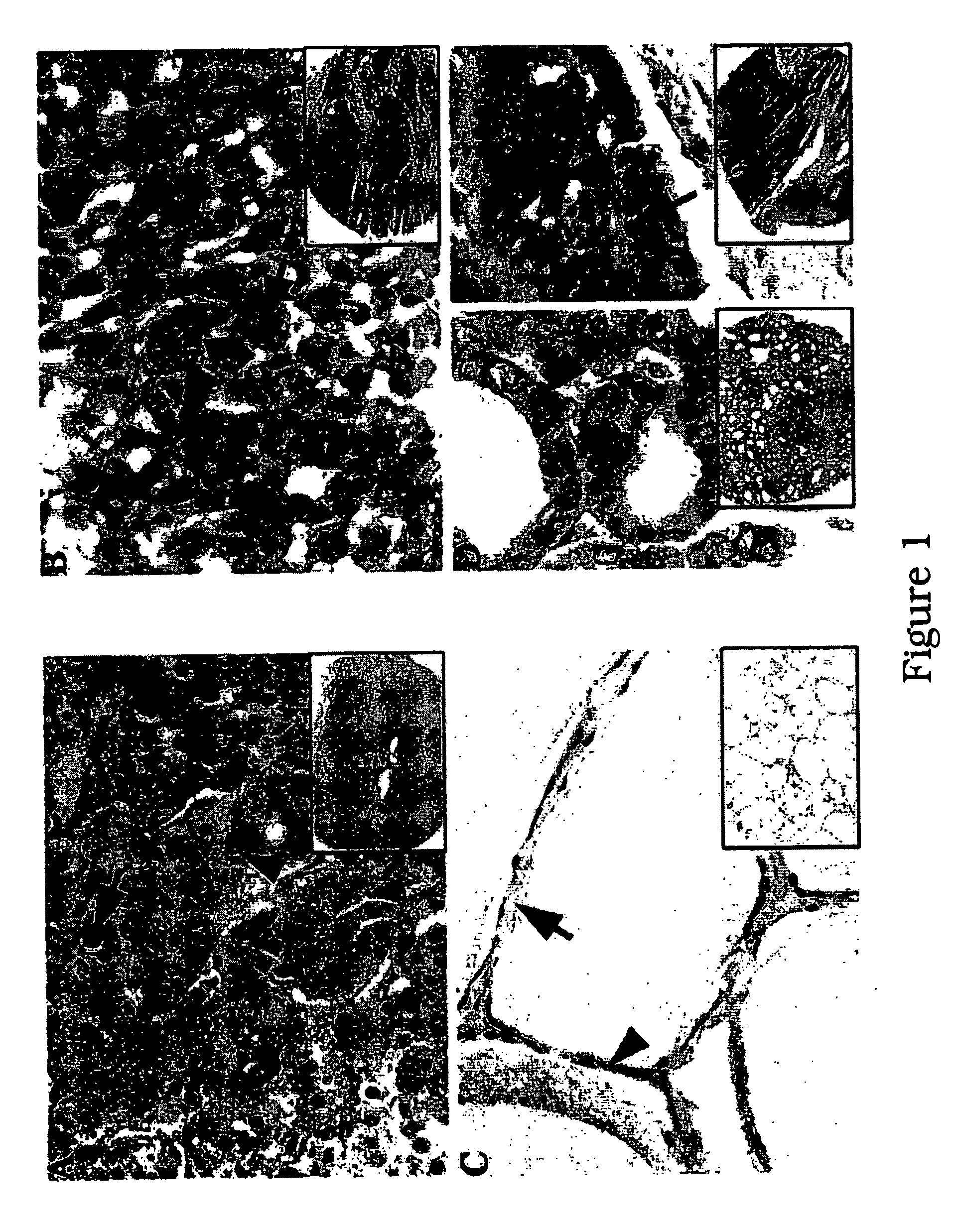 Method of diagnosis, treatment and useful agents for conditions characterised by modulation in the level of activin ssc