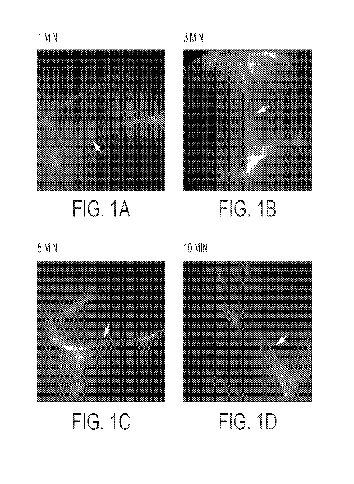 Imaging systems and methods for tissue differentiation, e.g., for intraoperative visualization