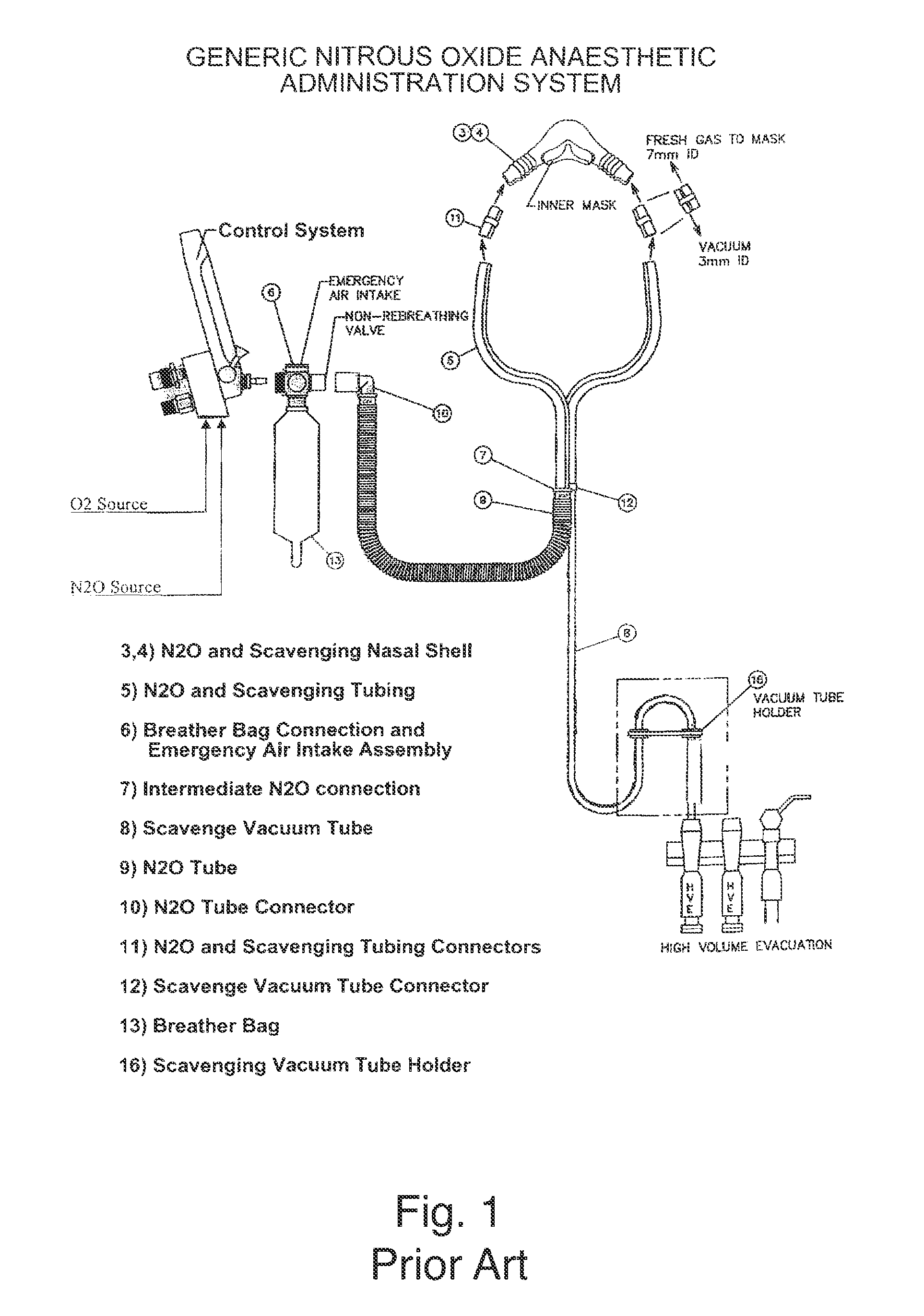 Nitrous Oxide Anesthetic Administration System