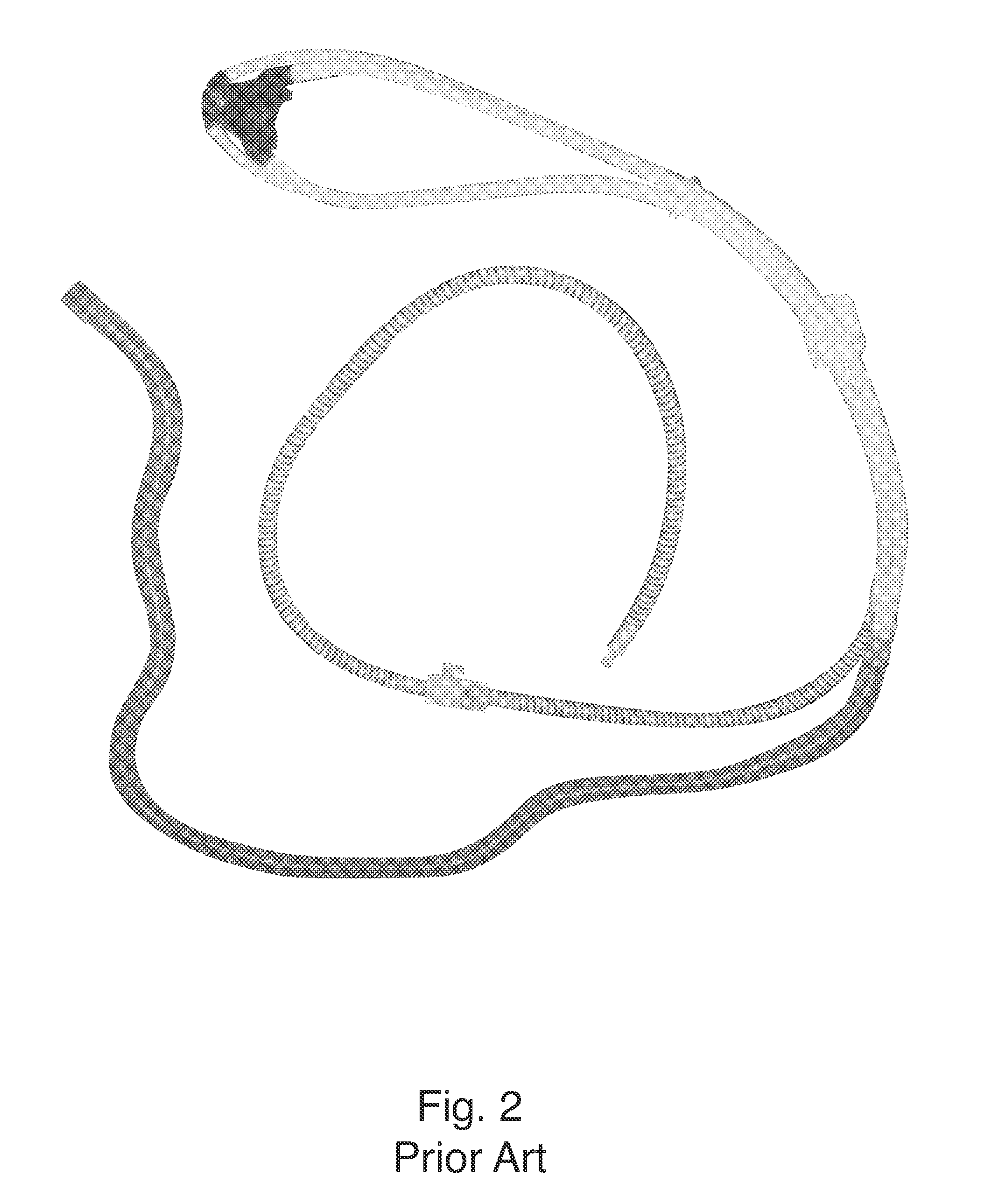 Nitrous Oxide Anesthetic Administration System