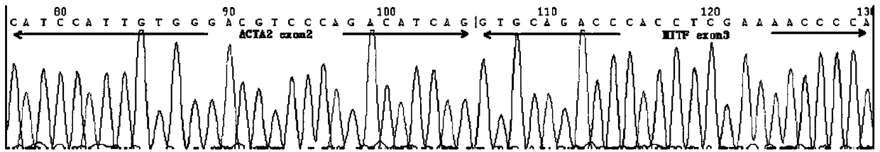 Probe assembly for diagnosing ACTA2-MITF translocation perivascular epithelioid cell tumor and application thereof