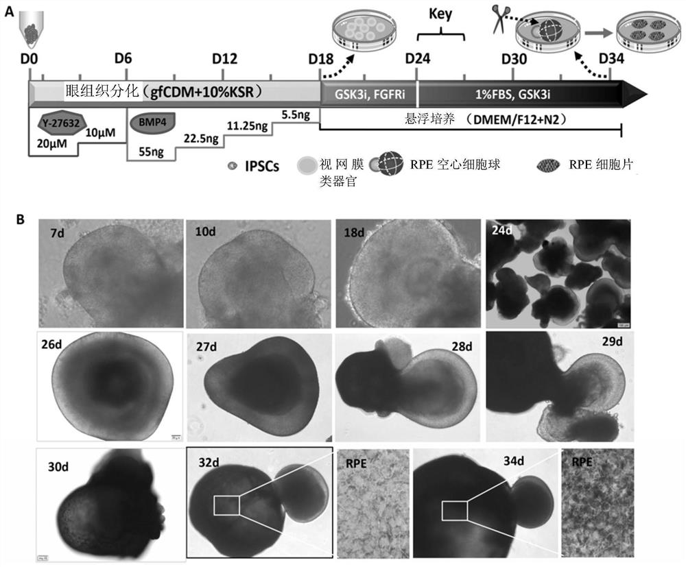 Preparation method of stent-free retinal pigment epithelial cell sheet